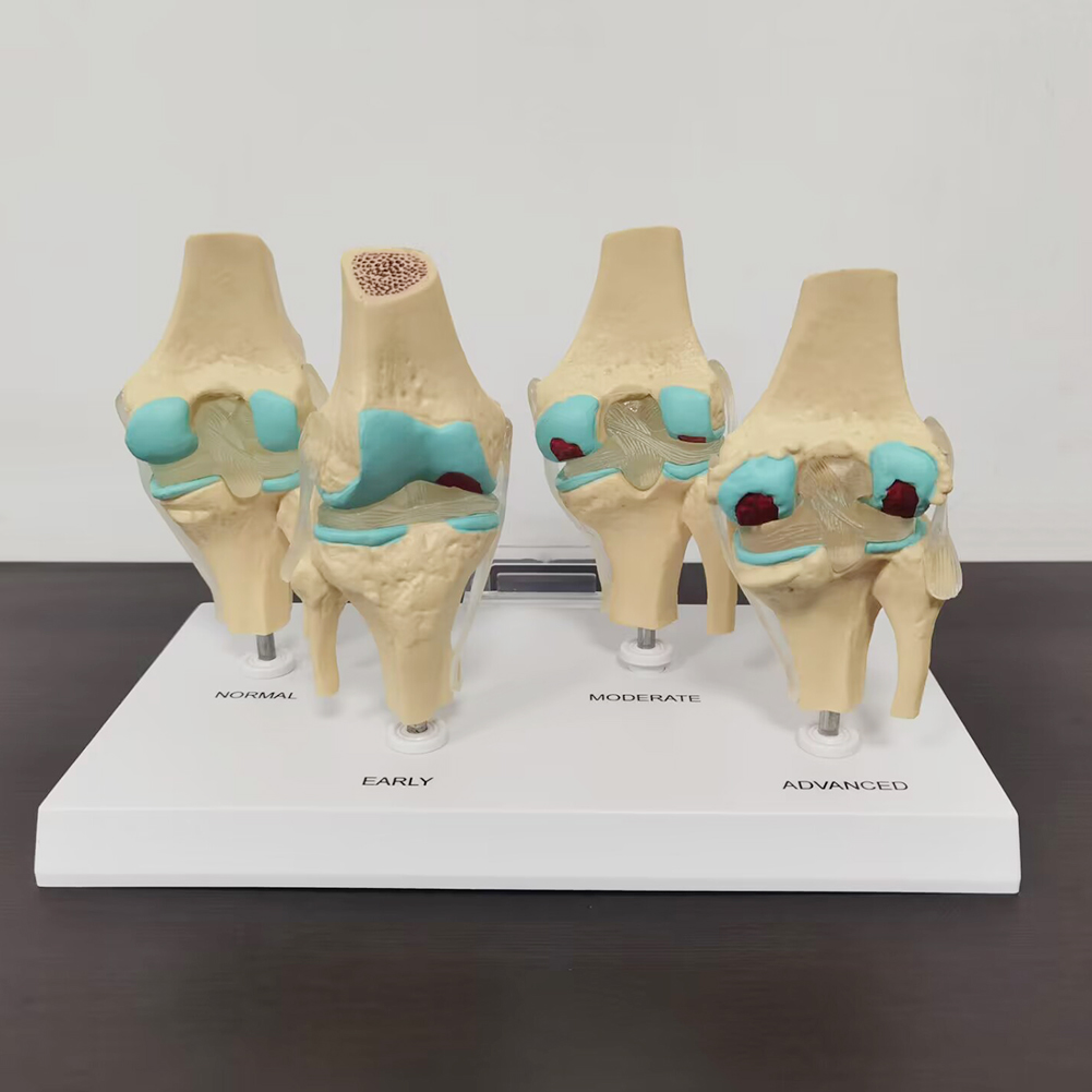 โมเดลข้อต่อเข่าแบบ4ขั้นตอนโมเด - Medical Lab Technology บทวิจารณ์และราคา