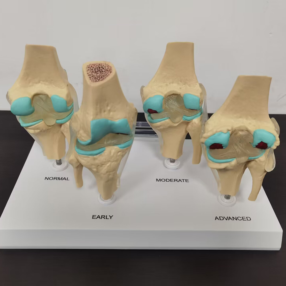 โมเดลข้อต่อเข่าแบบ4ขั้นตอนโมเด - Medical Lab Technology บทวิจารณ์และราคา