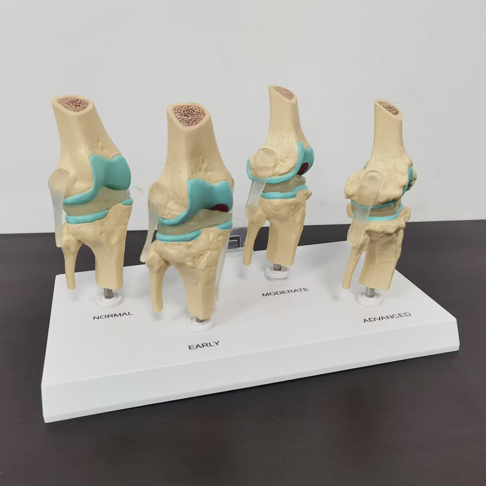 โมเดลข้อต่อเข่าแบบ4ขั้นตอนโมเด - Medical Lab Technology บทวิจารณ์และราคา